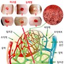 만병의 주범, 체내 염증, 림프액 다스리는 방법 이미지