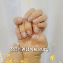 미프로네일
