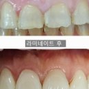 유디서현치과의원 이미지