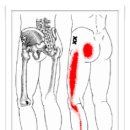 Gluteus Minimus (소둔근) 이미지