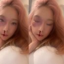 빌리스토리
