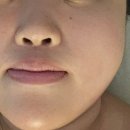 청담-136 | 청담 피부관리 몽마노 청담 특별한 괄사로 받는 속 시원한 관리 후기