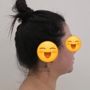 동수5길 | [W.07] 충주 아이로사 림프 관리 &amp; 윤곽관리 후기│ 충주 웨딩관리 추천