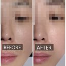 천지화장품 | 사당피부관리 천지빛깔 관리 후기 I 트러블과 모공케어 받았어요!
