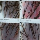 아프지마약국 - 안양시 만안구 장내로 164 | [부천/중동] 지루성두피염 앓았던 사람의 '헤드스파K 중동점' 두피 스케일링&디톡스 솔직후기