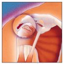 Shoulder Impingement 이미지