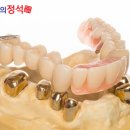 정석치과기공소 이미지