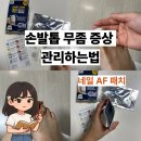 우신약국 | 손발톱 무좀 증상 집에서 편리하게 관리해보기