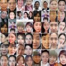 인셀덤 무엇인가!? 성형화장품으로 대박 행진 중인 인셀덤 직접 구매