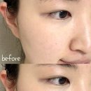 데일리 카 케어 | 다이소 화장품 추천 에이솔루션 어성초 칼라민 진정크림 꽃카에디션 사용후기