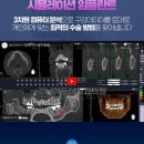 강남애프터치과 이미지