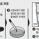 팔다리 마비환자, 줄기세포 이식받고 &#34;만세 삼창&#34; 이미지