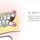 더꼼꼼한치과의원 이미지