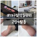 ✨️대구 발각질 제거 네일샵 고양이발톱 후기✨️