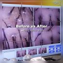 해운대빌딩B동 | 해운대탈모관리 WT메소드 해운대점 솔직후기