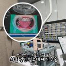 온누리청구약국 | 서울 성인 설소대 수술 설소대 제거 수술 내돈내산 솔직 찐후기