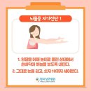 손제용신경과의원 | 해외에서 안면마비(Bell palsy)치료 및 회복 10일차 과정 후기, 호주 병원(지피) 예약 방법