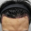 모나라피부과의원 이미지