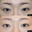 뷰라밸성형외과의원 이미지