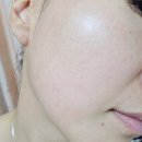 이토록뷰티 | 모공앰플 추천 서울뷰티위크 레오제이 극찬 브랜드 로에르네 포어 리프팅 캡슐 앰플 솔직 후기