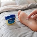 끈적해서 안 쓰던 바셀린…여름철 생활 고민 줄이는 방법 5가지 이미지