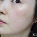 케이(K)-썸