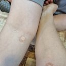 서울명진내과의원 네이버블로그