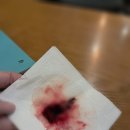 #1202 코숨한의원 7회차 후기