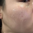 중계의원 | 노원 중계의원 (+5개월 리터치 후기)