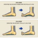 알스텝