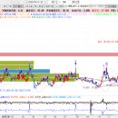 이화환경개발㈜ | 서연이화 주가 전망 : 저PBR 자동차부품주 분석, 매수 타이밍·목표가·손절가·수급 총정리
