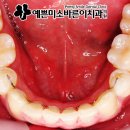 예쁜미소바른이치과의원 이미지