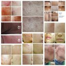 한국레이져메디칼 이미지