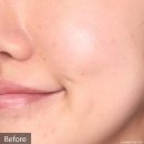 ㈜조은에너지 | 피부에 주사는 NO! 7일이면 주름펴지는 스킨부스터 추천!