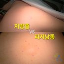 성누가외과의원 네이버블로그