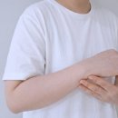 마크 | 튼살없애는법, 순한 임산부 튼살 크림 아토팜 스트레치 마크 크림 후기