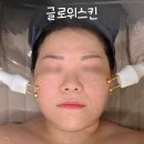 브레라인에스테틱 | 대전 피부관리 글로위스킨 내돈내산 용산동 하이엔드 에스테틱 재방문 후기