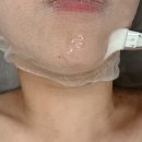 79대포 청주가경덕일점 | 청주ㅣ'올가드림뷰티 청주가경점' 모공디톡스 피부관리