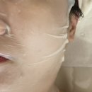 해오름1호 | [대치동피부관리, 대치동여드름] 해오름피부미용