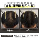 블랙인스칼프 이미지