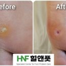 힐앤풋 이미지