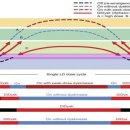 파킨슨병의 Diphasic Dyskinesia(이상운동증) 이미지
