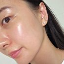 대치건강식품 | 대치역 피부과 티베룩 티타늄리프팅 팔자 쥬베룩볼륨 결절 부작용, 시술 통증 후기