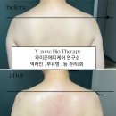 국제선순환반려협회 | 광주와이존테라피·광주예신관리 후기｜멜로우왁싱피부 광주전대점