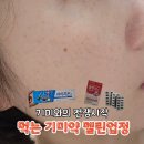 (주)시어스제약 | 기미와의 싸움시작 약국구매 먹는기미약 엘시스테인 글루타티온