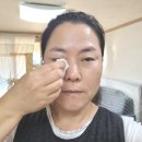 잦은 눈충혈되시는 분들 안과가기전 이에스루테인으로 눈건강영양제 부터 챙기세요~