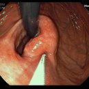 위내시경 하고 대학병원급 이상으로 가보라고 소견서 받았는데.... 이미지