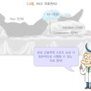 반월판 연골파열의 증상과 치료 이미지