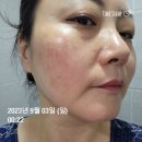 안산 선부동 제이미의원/3회차방문 후기(내돈내산)