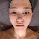 부천-범박-74 | 부천 소사 문제성피부관리 및 모공축소 전문 [보니따 에스테틱]